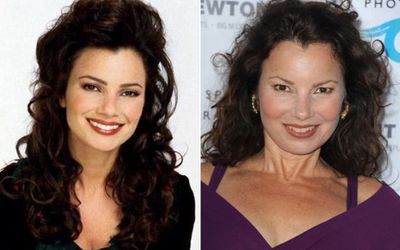 Did  Fran Drescher Had Plastic Surgery? Find It Out Here